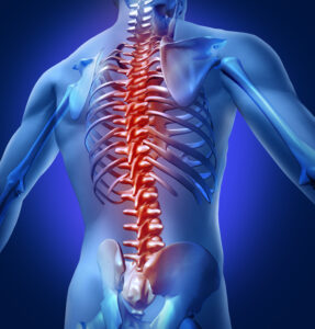 spondylodese, diagnose