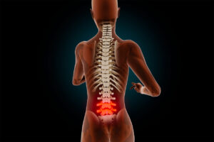 spondylodese, wervelkolom, ruggenwervels, L4-L5