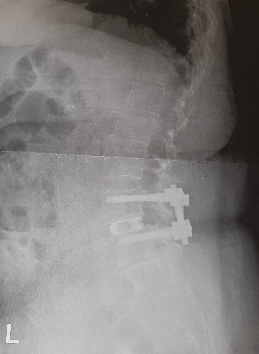 rontgenfoto, ziekenhuis